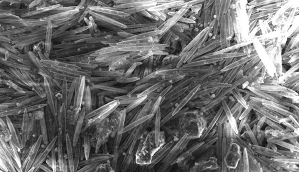 Nitzschia palea colonies