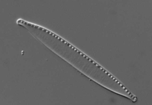 A diatom under a microscope