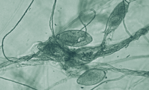 Spores under a microscope
